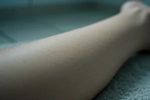 Epilation Mastery: Smoothness for Weeks in 2026