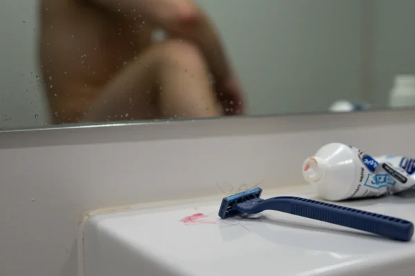 Laser Hair Removal Fails: 70% Avoidable in 2026