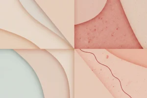 Lumea vs. Waxing: 2026 Truth for Sensitive Skin